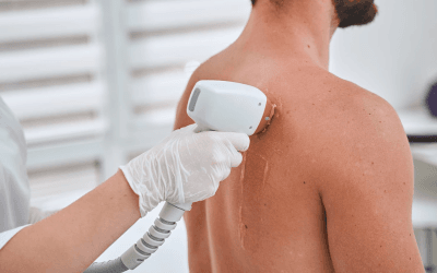 How Cold Laser Therapy Treatment Helps Ease Lower Back Pain